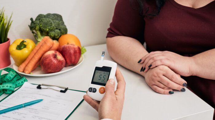 Measuring blood sugar. Nutritionist using glucometer tests overweight woman's blood sugar, prevention control of diabetes