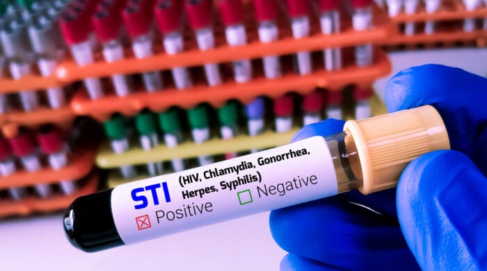 Biochemist or Lab Technologist holds Blood sample for STI or Sexually Transmitted Infection Test with laboratory background.