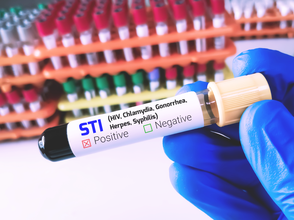 STIs on the Rise: What You Need To Know - WWMG Blog